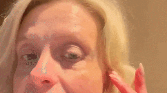 W&H Tester Network member Jenny Church demonstrating the impact of Anua Niacinamide 10% + TXA 4% Serum on her skin