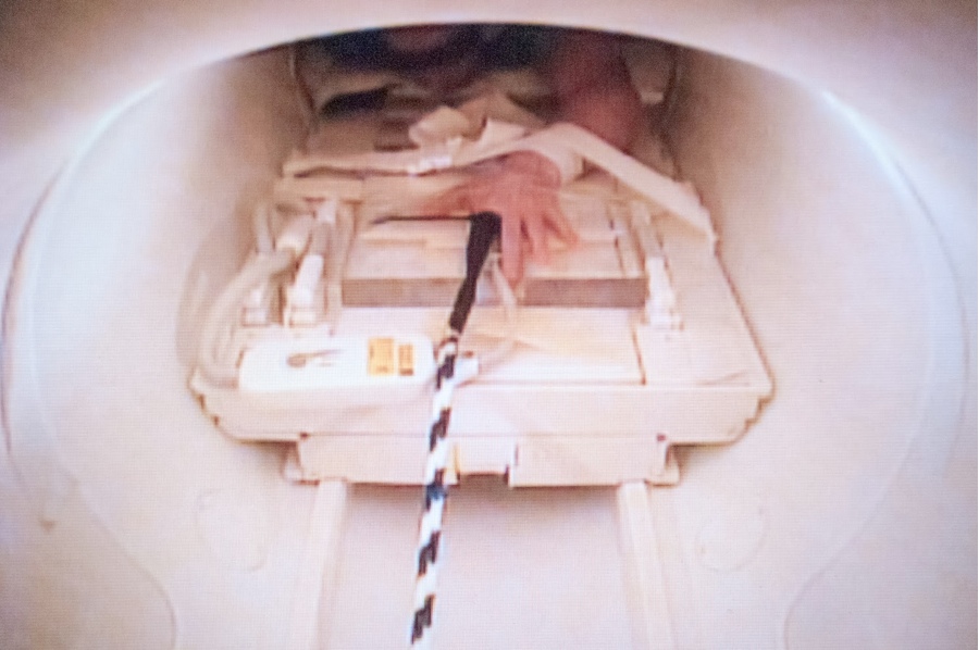 Using MRI, researchers recorded what happened inside the finger joint in real-time as each the subject's fingers was pulled slowly until the joints cracked.