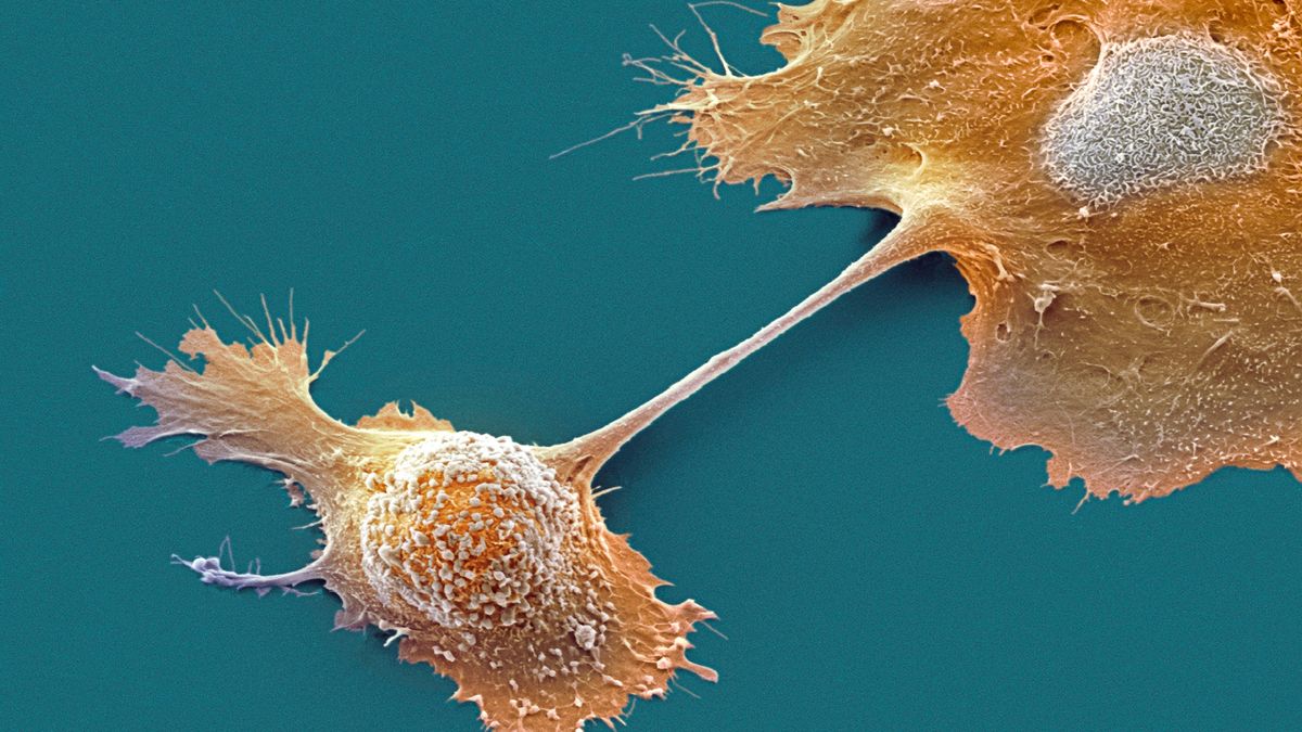 Experimental drug doubles one-year survival in pancreatic cancer