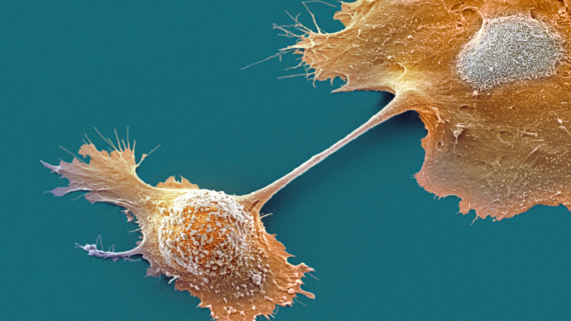 A microscopic image shows two orange cells attached by a strand between them, against a dark blue background