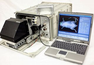 Bone Densitometer for International Space Station