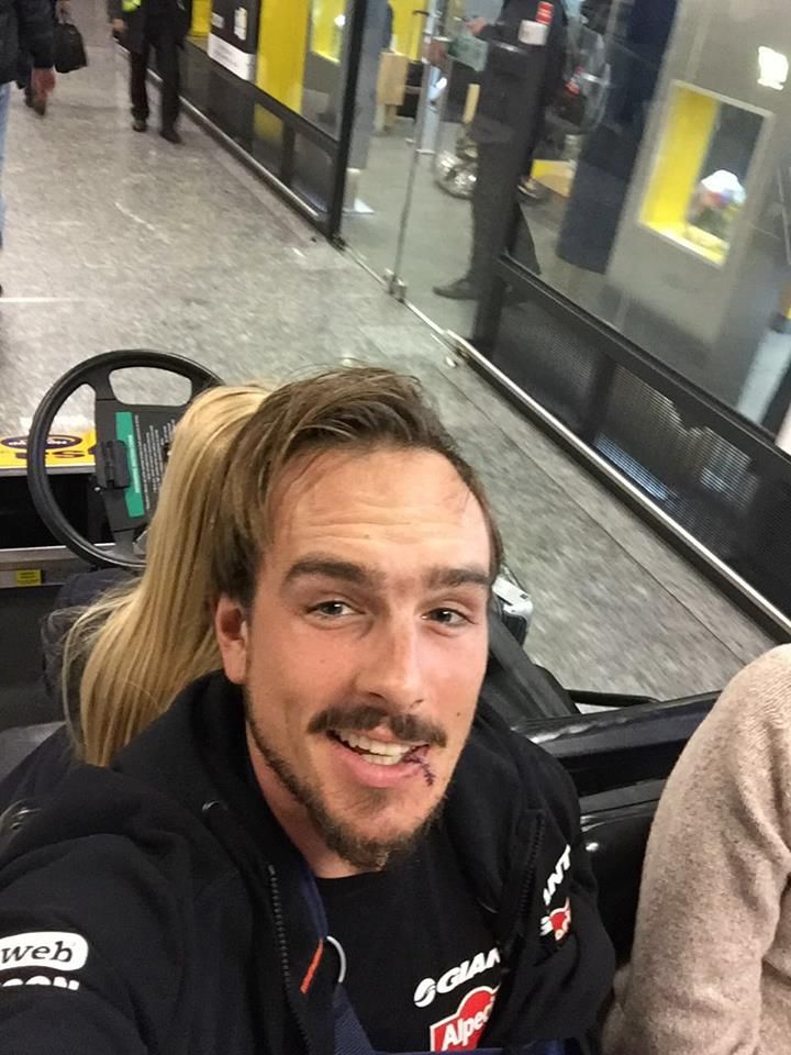 John Degenkolb a few days after his training crash in Calpe