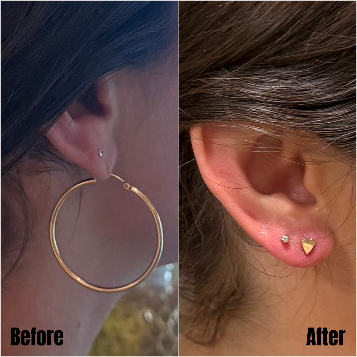 Side-by-side close-ups of the same earlobe. Left: a stretched piercing with a hoop earring hanging low. Right: the healed earlobe with a newly repierced, centered stud.