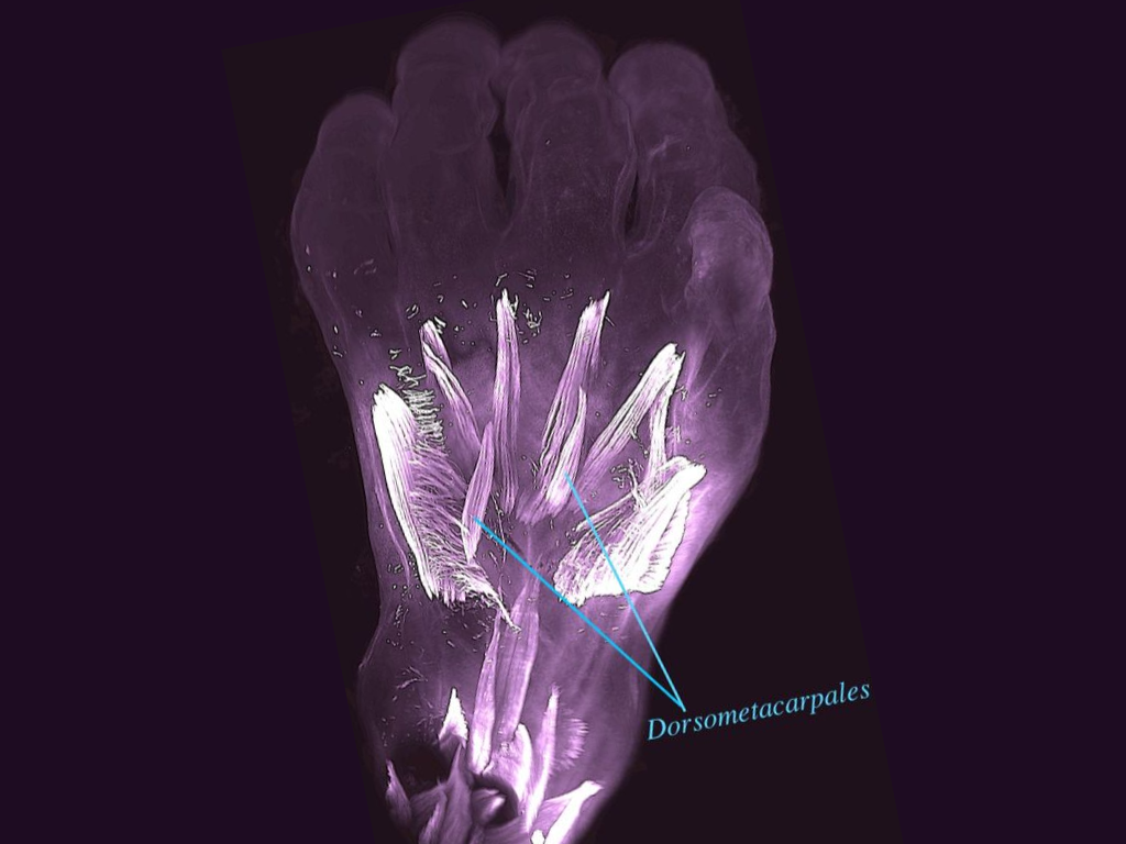 10 week old fetal human hand with muscles highlighted