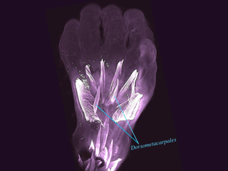 10 week old fetal human hand with muscles highlighted