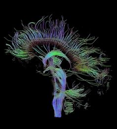 Neural connections.