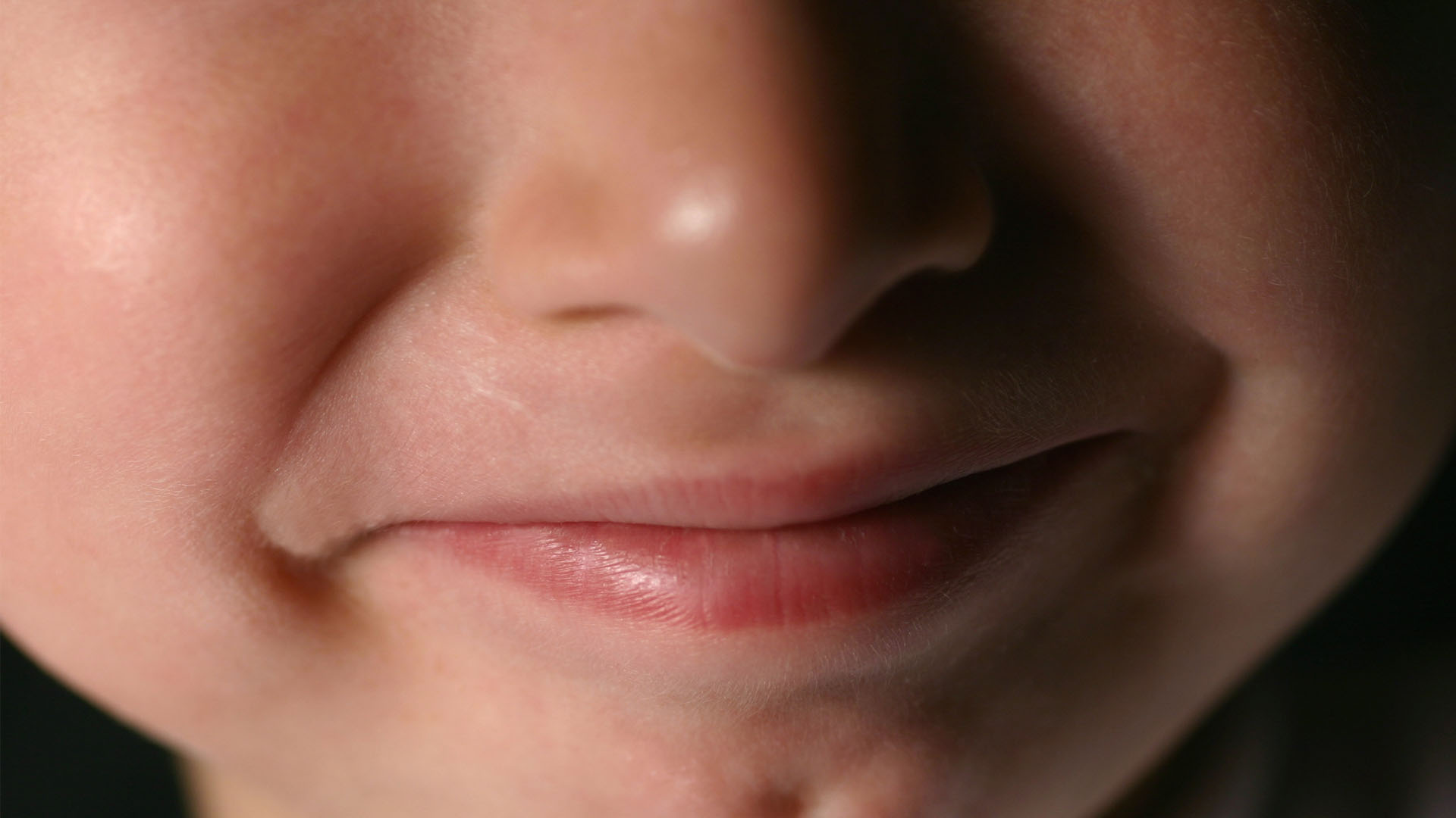 Image depicts a close up of a young boy's face with a cleft chin or chin dimple
