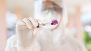 Your blood type may affect your susceptibility to coronavirus, new study suggests