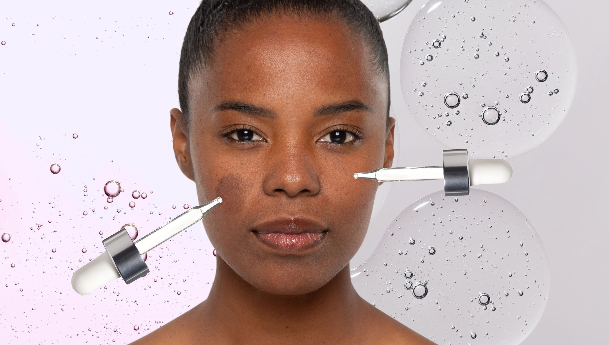 Azelaic Acid vs. Niacinamide: Which Is Better for Dark Spots?