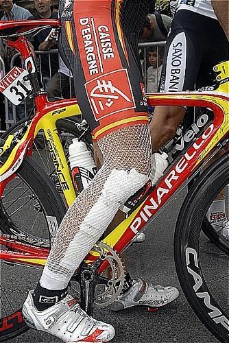 Valverde's right leg was still bandaged after his crash on Wednesday.