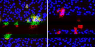 SARS-CoV-2 tends to develop mutations in certain spots, which "disguise" the virus from antibodies. The image on the left shows multiple antibodies (green and red) binding to SARS-CoV-2 within cells (blue). On the right, deletions in SARS-CoV-2 stop neutralizing antibodies from binding (absence of green) but other antibodies (red) still attach very well.