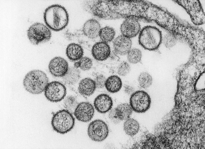 The 12 Deadliest Viruses On Earth Live Science 