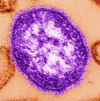 A single virus particle, or "viron", of the measles virus.