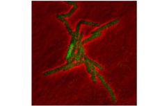 antibiotic resistant bacteria