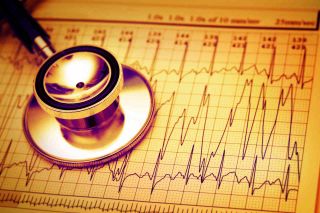 Stethoscope lying on ECG graph