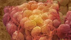Colored scanning electron micrograph (SEM) of a sample of fat tissue, showing fat cells (adipocytes, red yellow) surrounded by fine strands of supportive connective tissue.