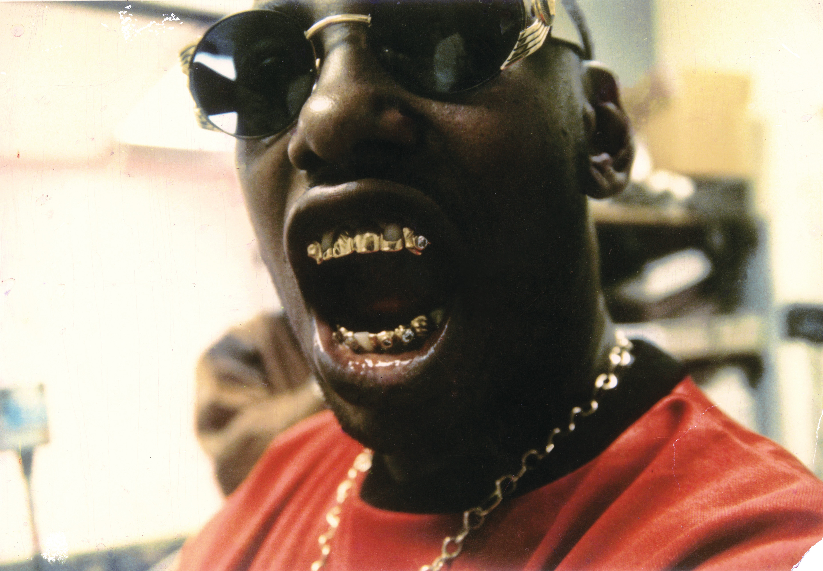gold teeth