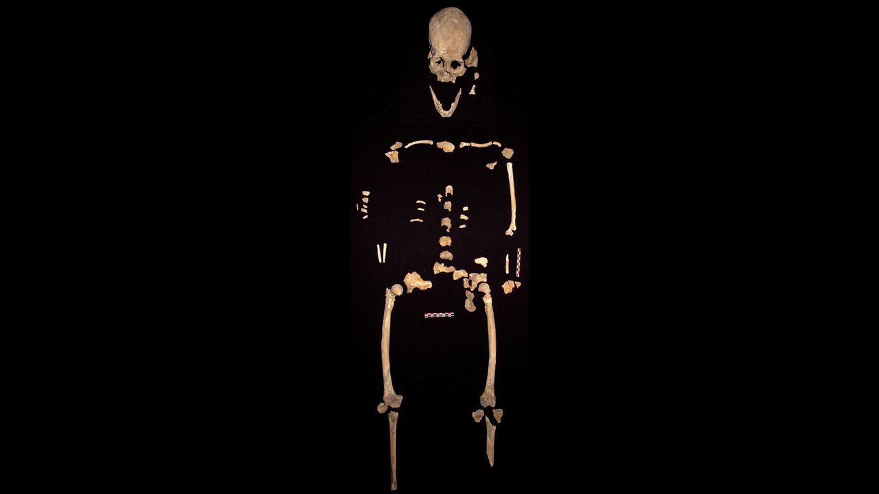 The woman's skeleton is about 30% complete.