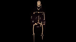 The woman's skeleton is about 30% complete.