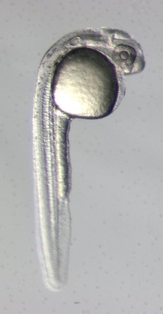 Without certain lincRNAs, this normal zebrafish embryo would have an irregularly shaped head.