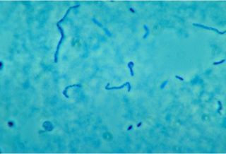 An image of <em>Fusobacterium necrophorum<em> a type of bacteria that is the most common cause of Lemierre syndrome, a rare infection that's been dubbed a "forgotten disease."