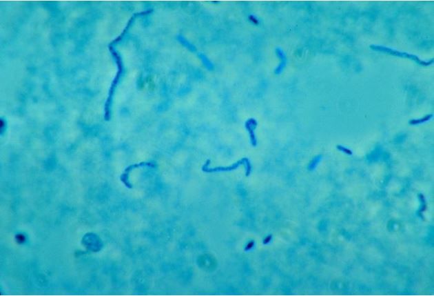 An image of &lt;em&gt;Fusobacterium necrophorum&lt;em&gt; a type of bacteria that is the most common cause of Lemierre syndrome, a rare infection that&#039;s been dubbed a &quot;forgotten disease.&quot;