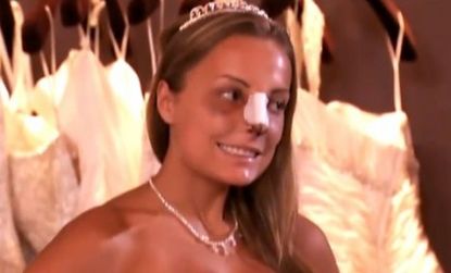 "Bridalplasty" contestant Cheyenne Aikens "earns" herself a nose job but is still hoping for liposuction and a gum reduction before her wedding day.