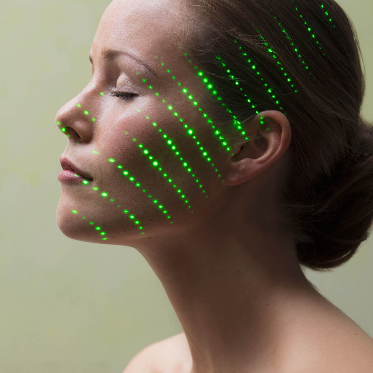 Laser facial