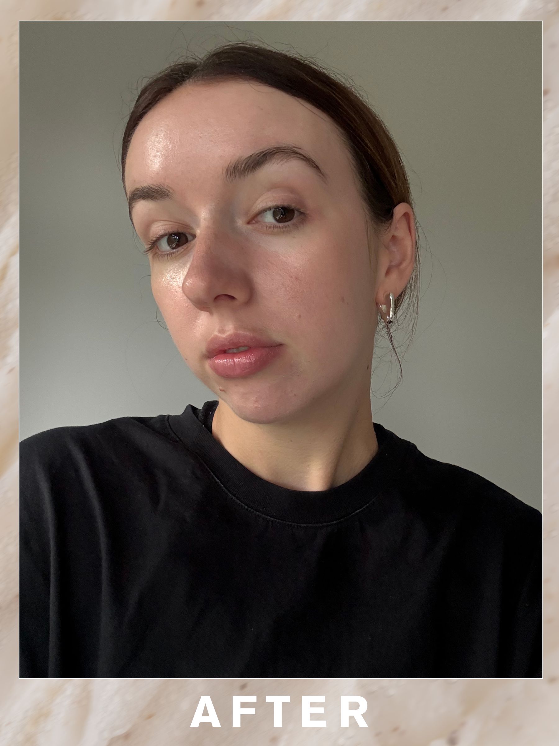Megan after her Oskia Signature Glow Facial