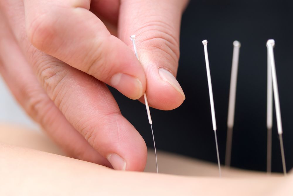 Stop Those Awful Pains With Acupuncture