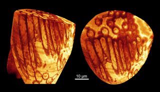 giant sperm in seminal vesicles