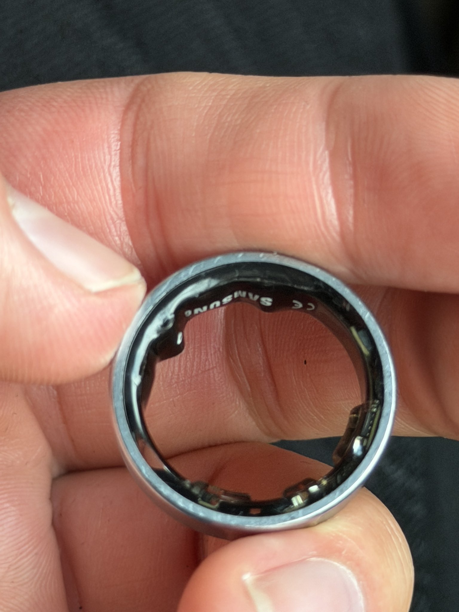 Swollen Samsung Galaxy Ring on the finger of Daniel Rotar