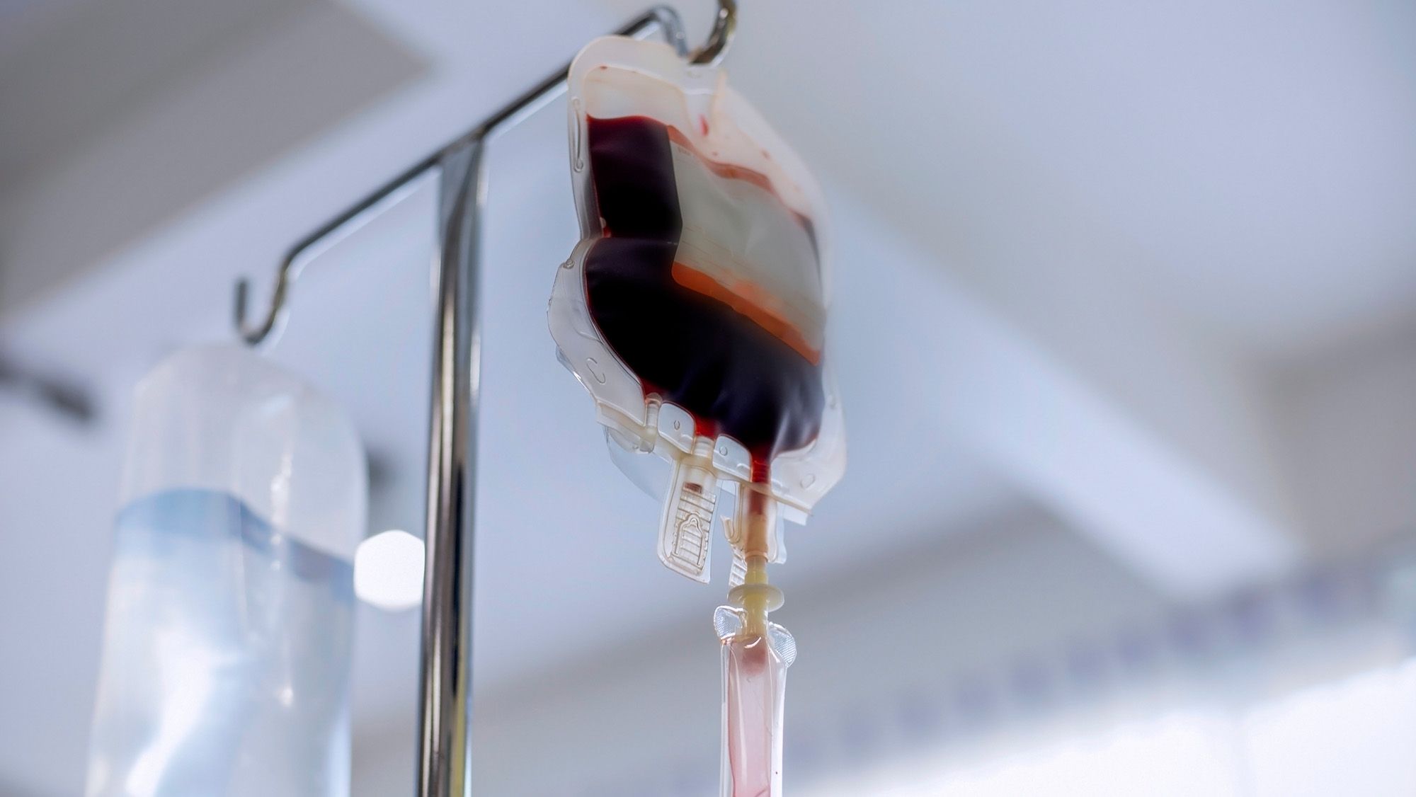 Diagnostic dilemma: 6-year-old develops life-threatening allergic reaction after blood transfusion Diagnostic dilemma: 6-year-old develops life-threatening allergic reaction after blood transfusion