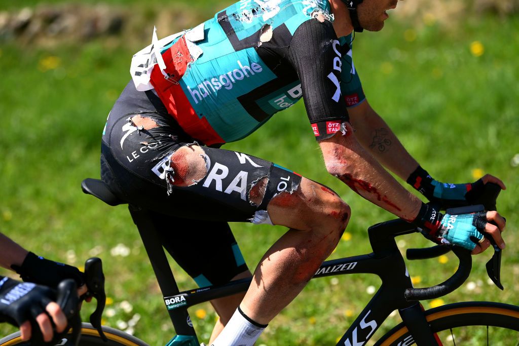 SAN MARTINO DI CASTROZZA ITALY APRIL 18 Detailed view of Ben Zwiehoff of Germany and Team Bora Hansgrohe injury after crash during the 45th Tour of the Alps 2022 Stage 1 a 1609km stage from Cles to PrimieroS Martino di Castrozza 708m TouroftheAlps on April 18 2022 in San Martino di Castrozza Italy Photo by Tim de WaeleGetty Images