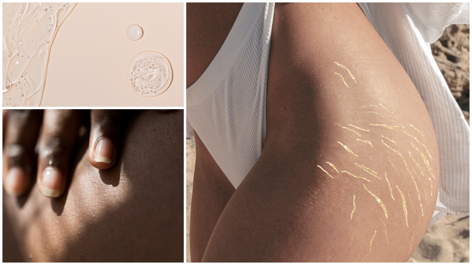 Scar treatments and types