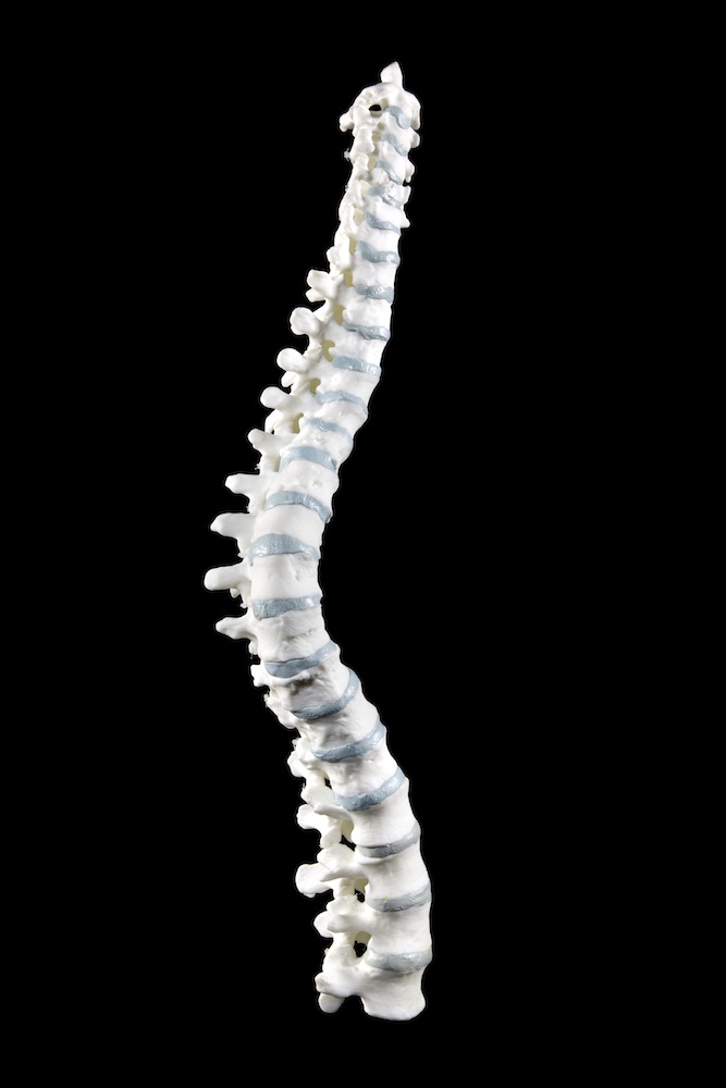 richard iii spine model
