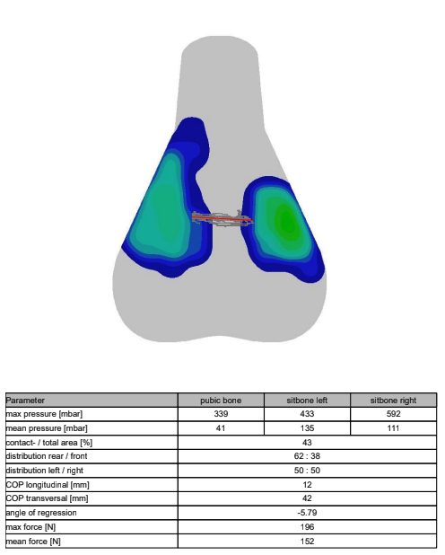 A visual output of saddle pressure mapping