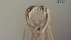 A hookworm under a microscope.