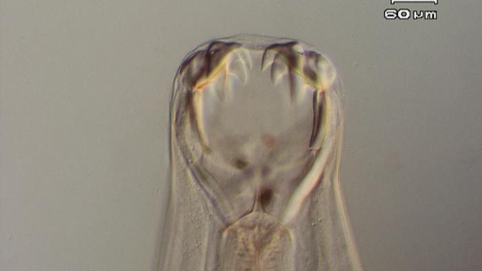 A hookworm under a microscope.