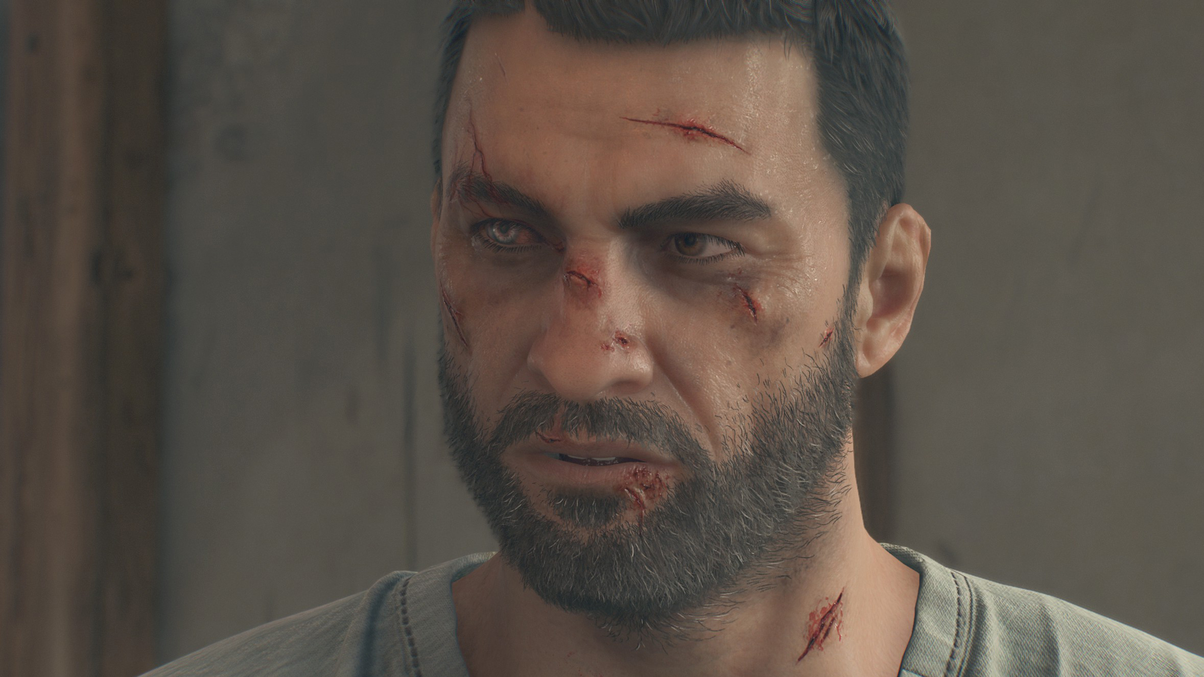 Kyle Crane with cuts on his face