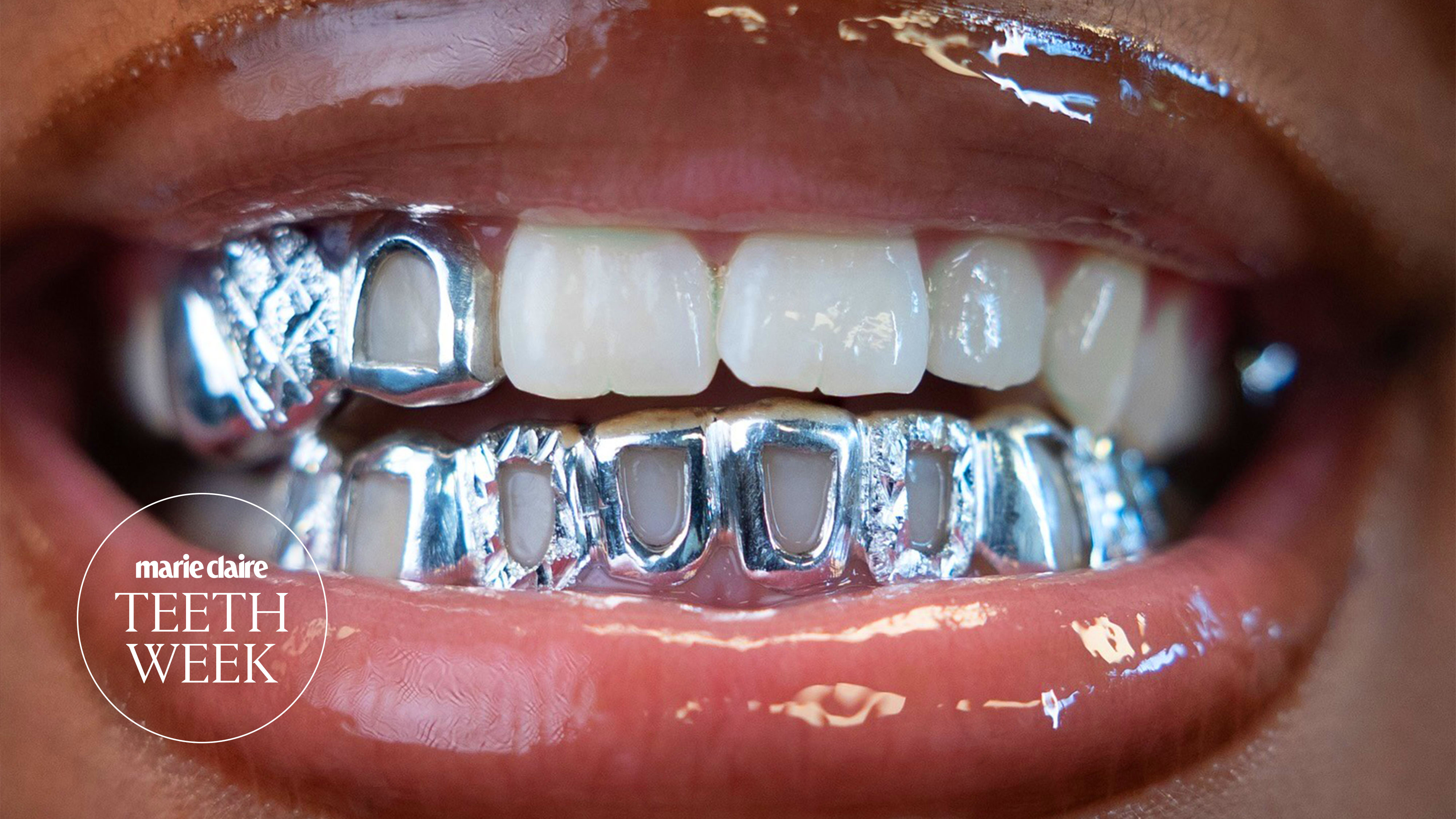 silver grillz