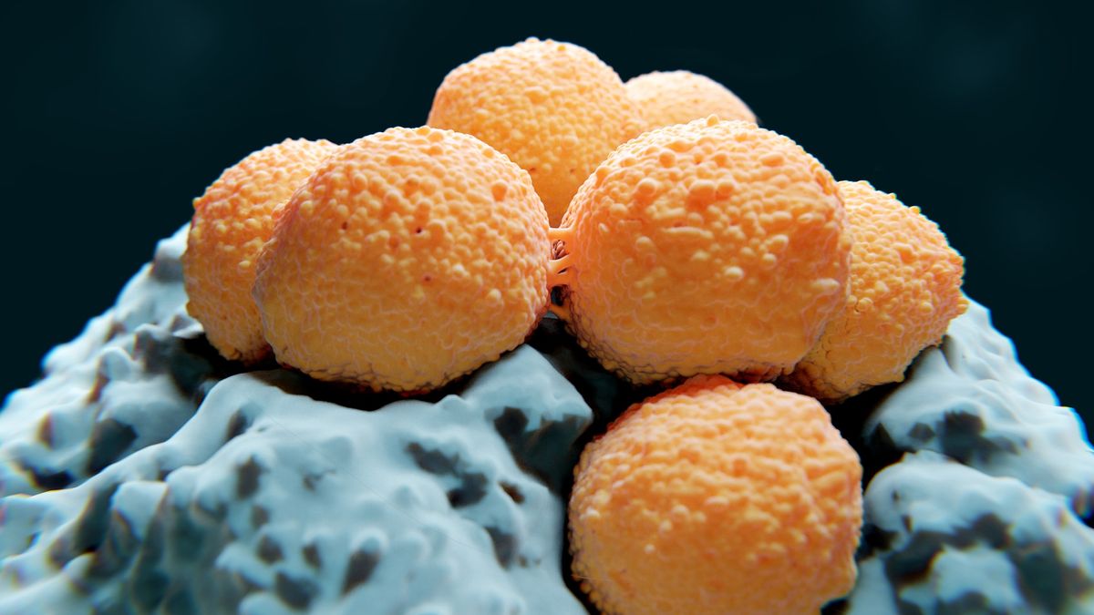 an illustration of orange Streptococcus bacteria on top of light blue tissue