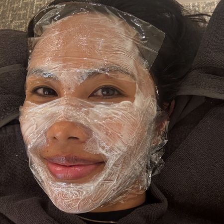 Vanessa Lee PicoSure Pro Laser Review