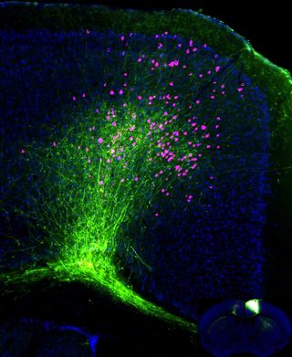 Neuron bodies in a mouse brain are shown in pink, and their projections (axons) in green.