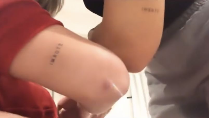 Skin, Human leg, Arm, Thigh, Leg, Joint, Blond, Close-up, Human body, Hand,