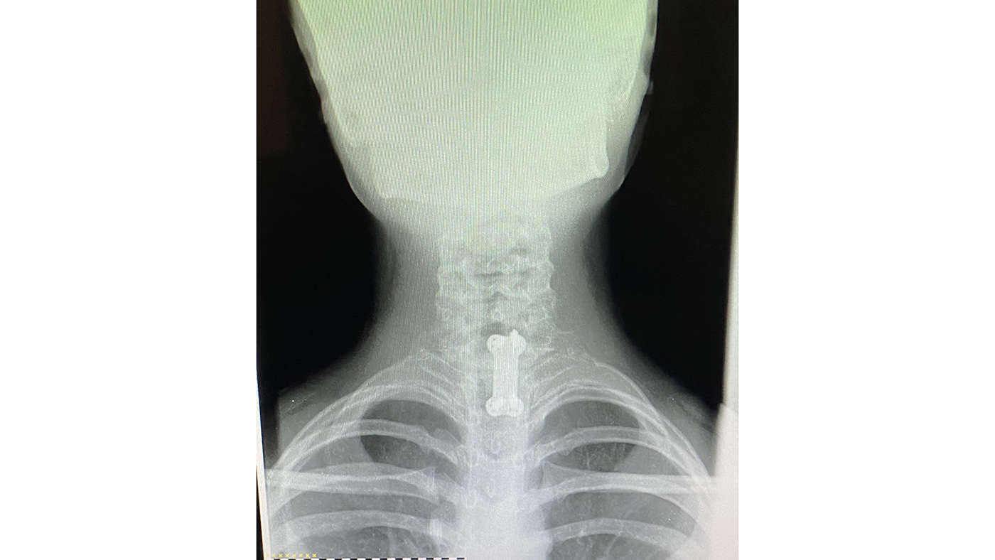 x-ray
