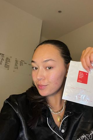 Alice Carter wearing COSRX Master acne patches