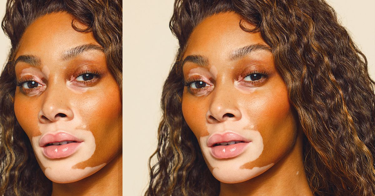 Model Winnie Harlow Spills Her Beauty Secrets And More