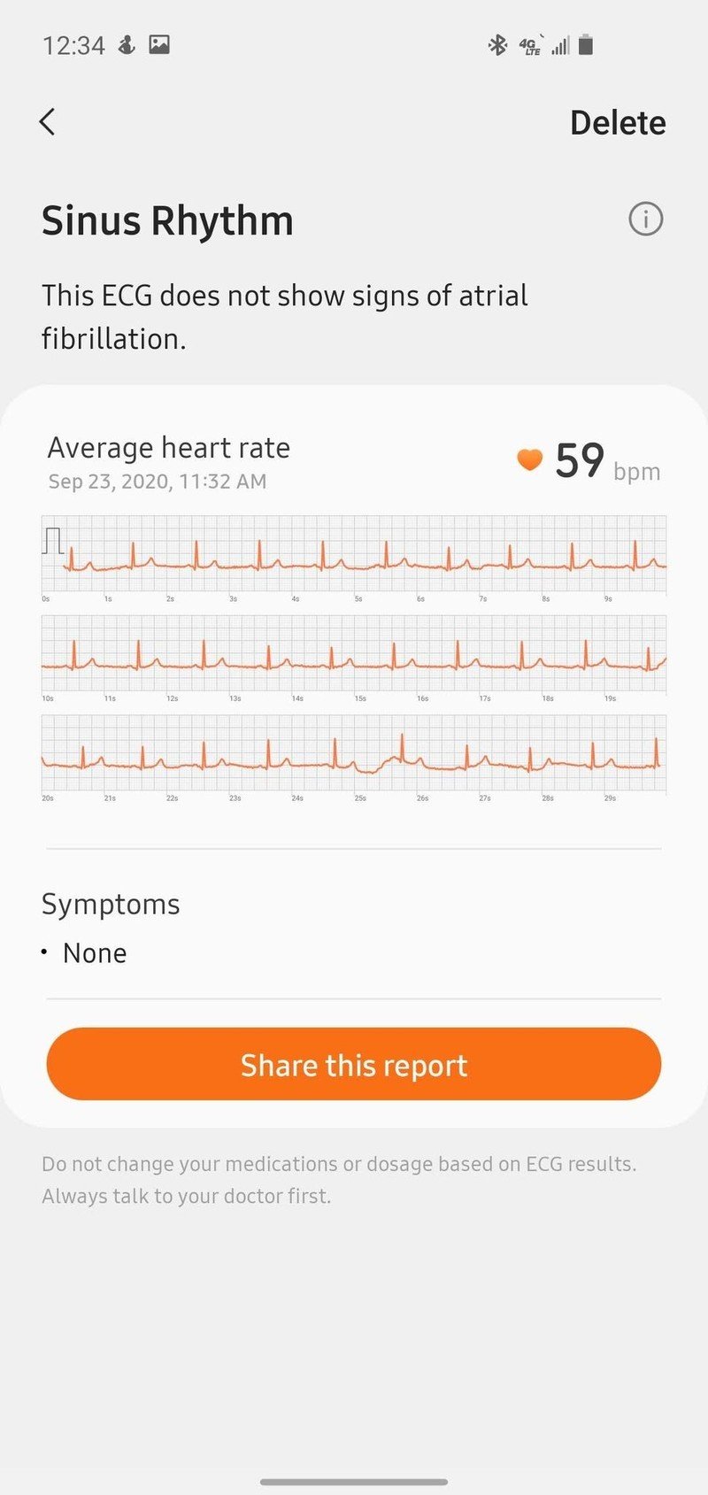 Samsung Health Monitoring 2ecg