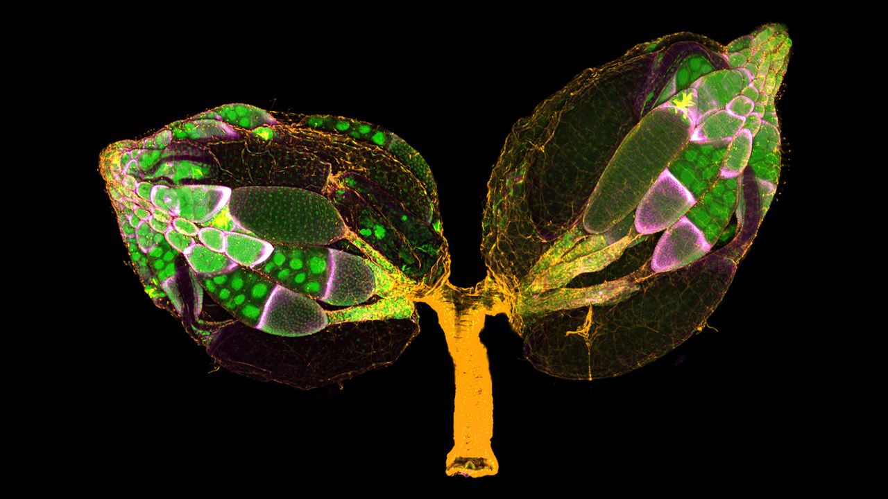 A pair of ovaries from an adult female fruit fly.